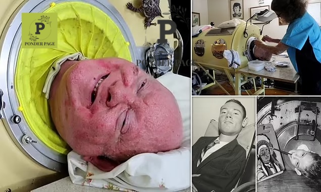 Remembering Paul Alexander: The Man in the Iron Lung Who Inspired Generations